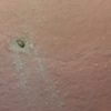 Disinfestazione da Insetti